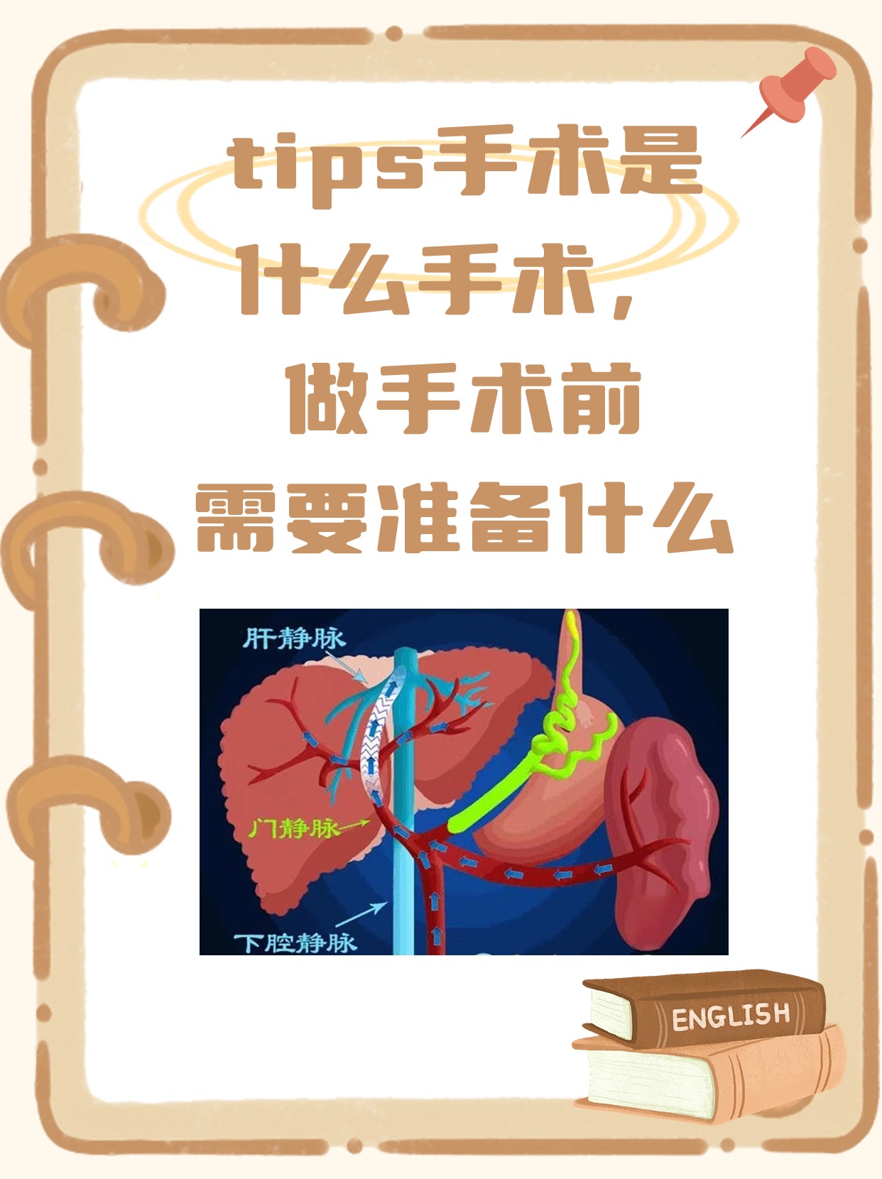 速看!进行tips手术前需要注意这些事项!