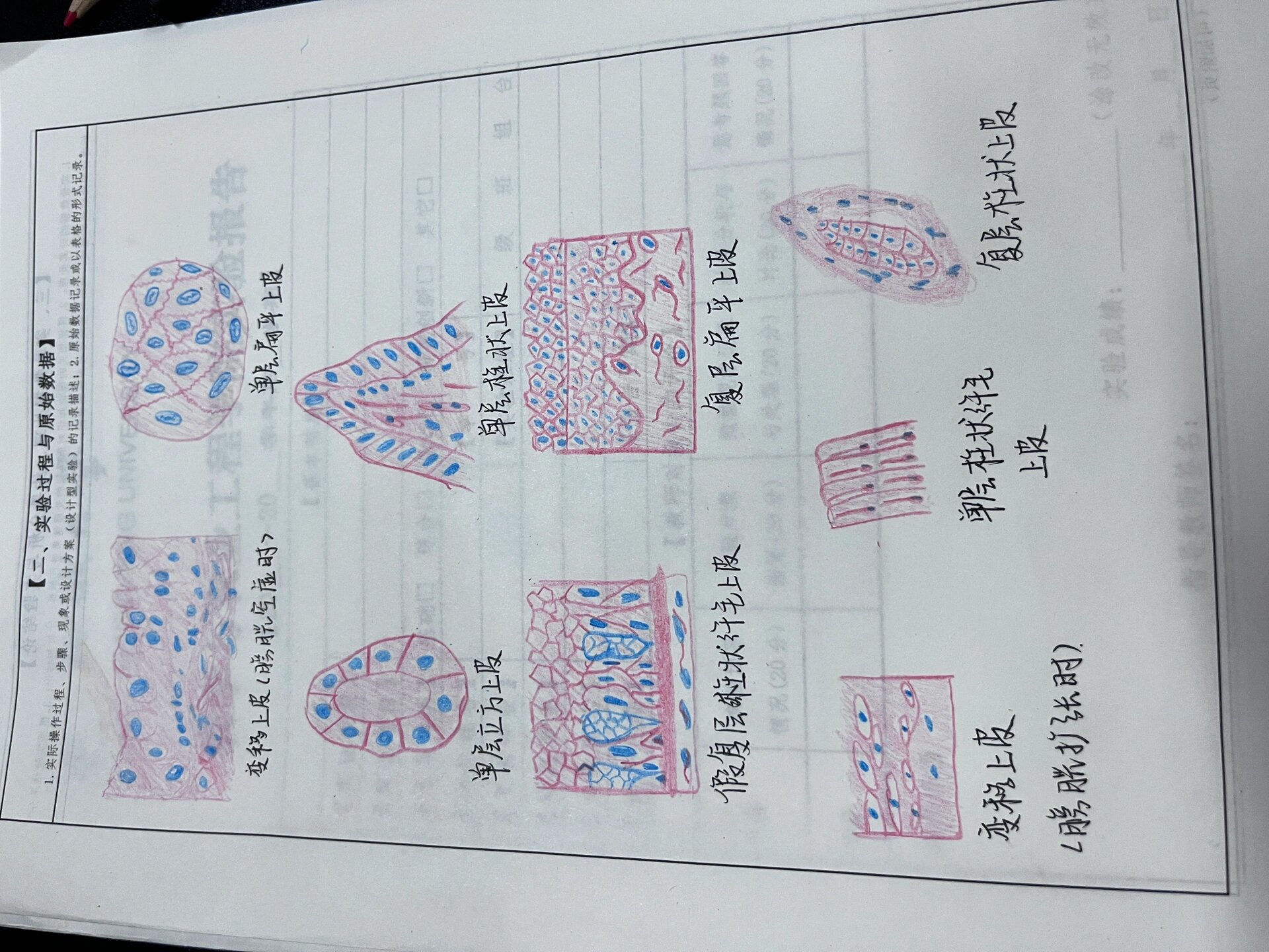  p>红蓝铅笔画图 br>1,变移上皮(膀胱空虚时)  br>2,单层扁平上皮  br