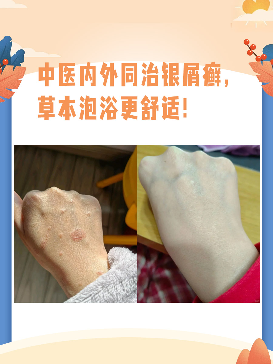  p>前段时间奶奶的皮肤上有很多红斑,而且还很痒,我准备带奶奶去医院