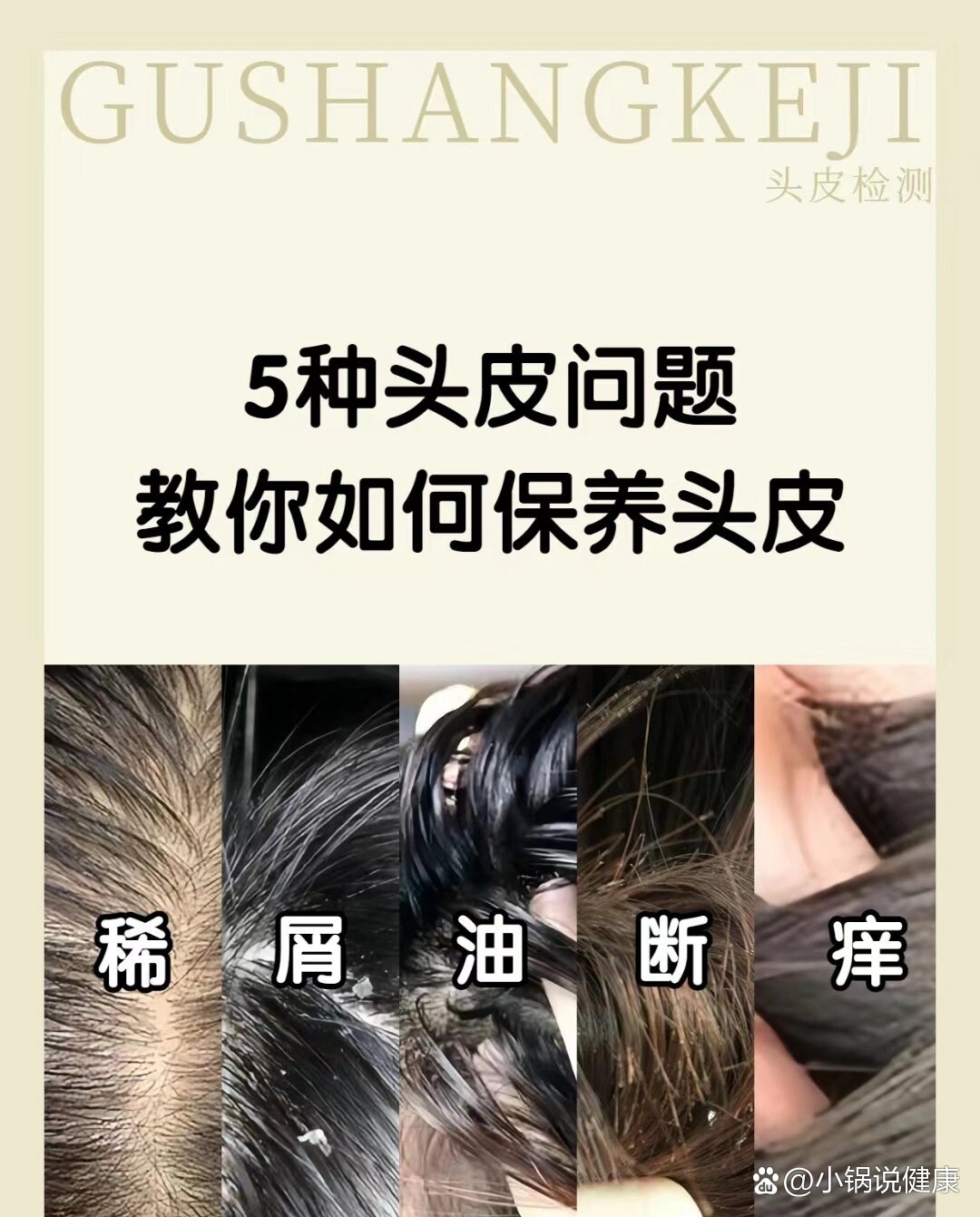 常见五种头皮问题