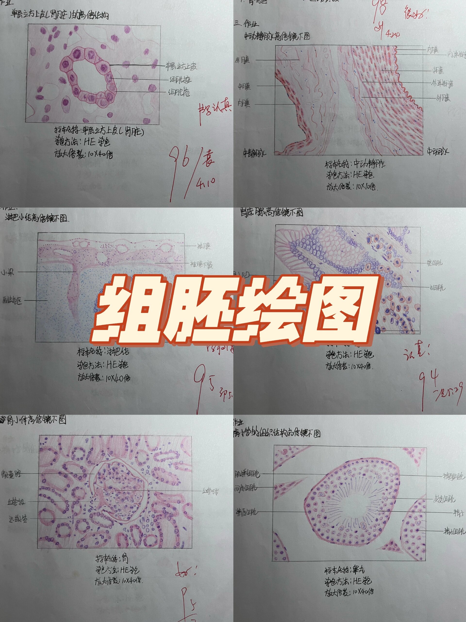 胸腺小体红蓝绘图图片