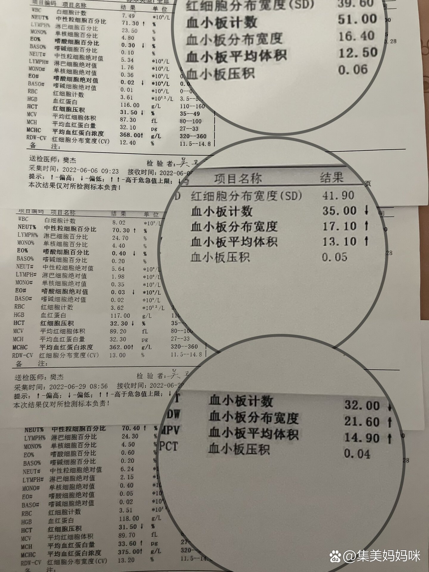 血小板低的化验单图片图片