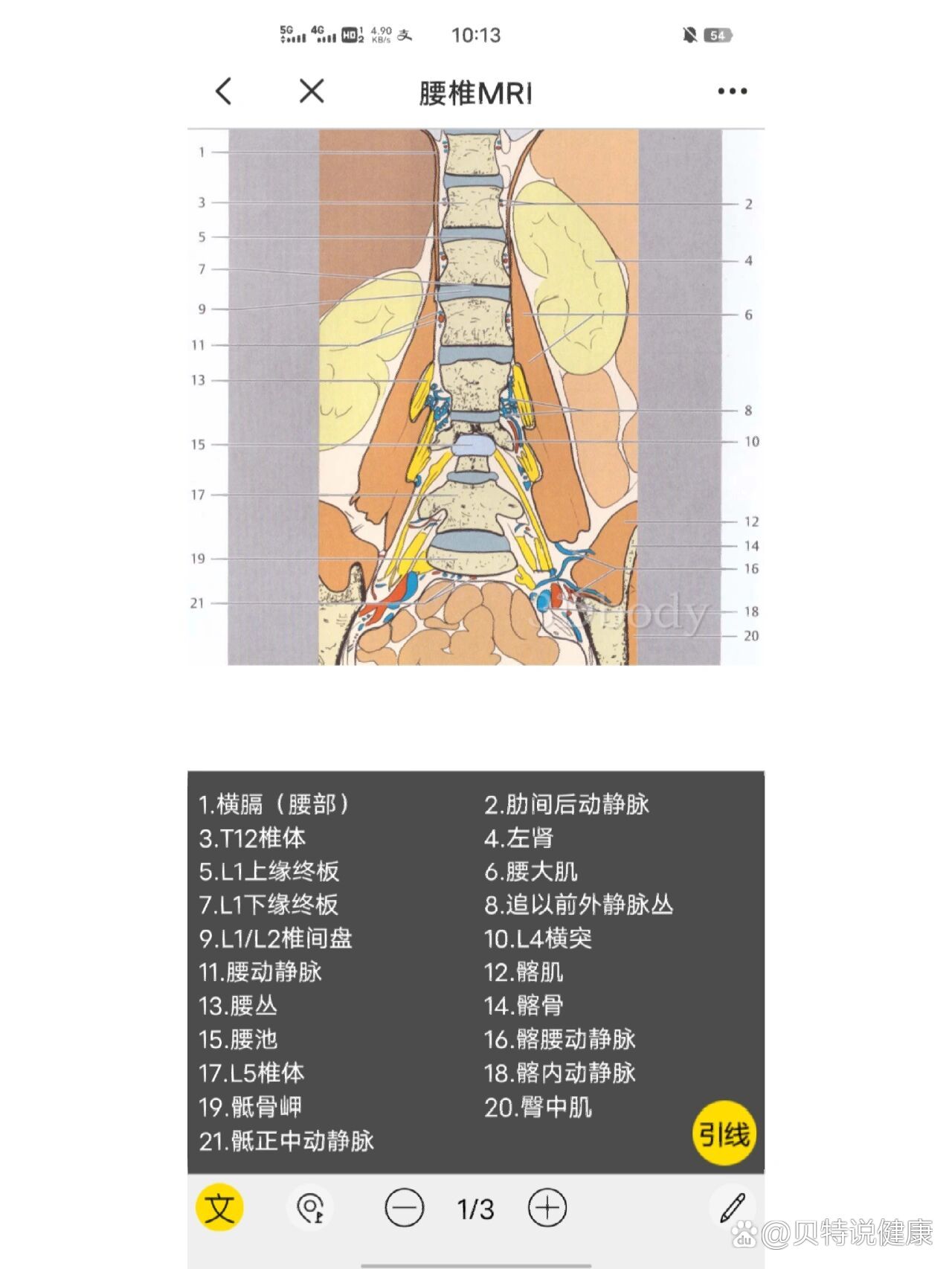 腰椎核磁共振片子图解图片