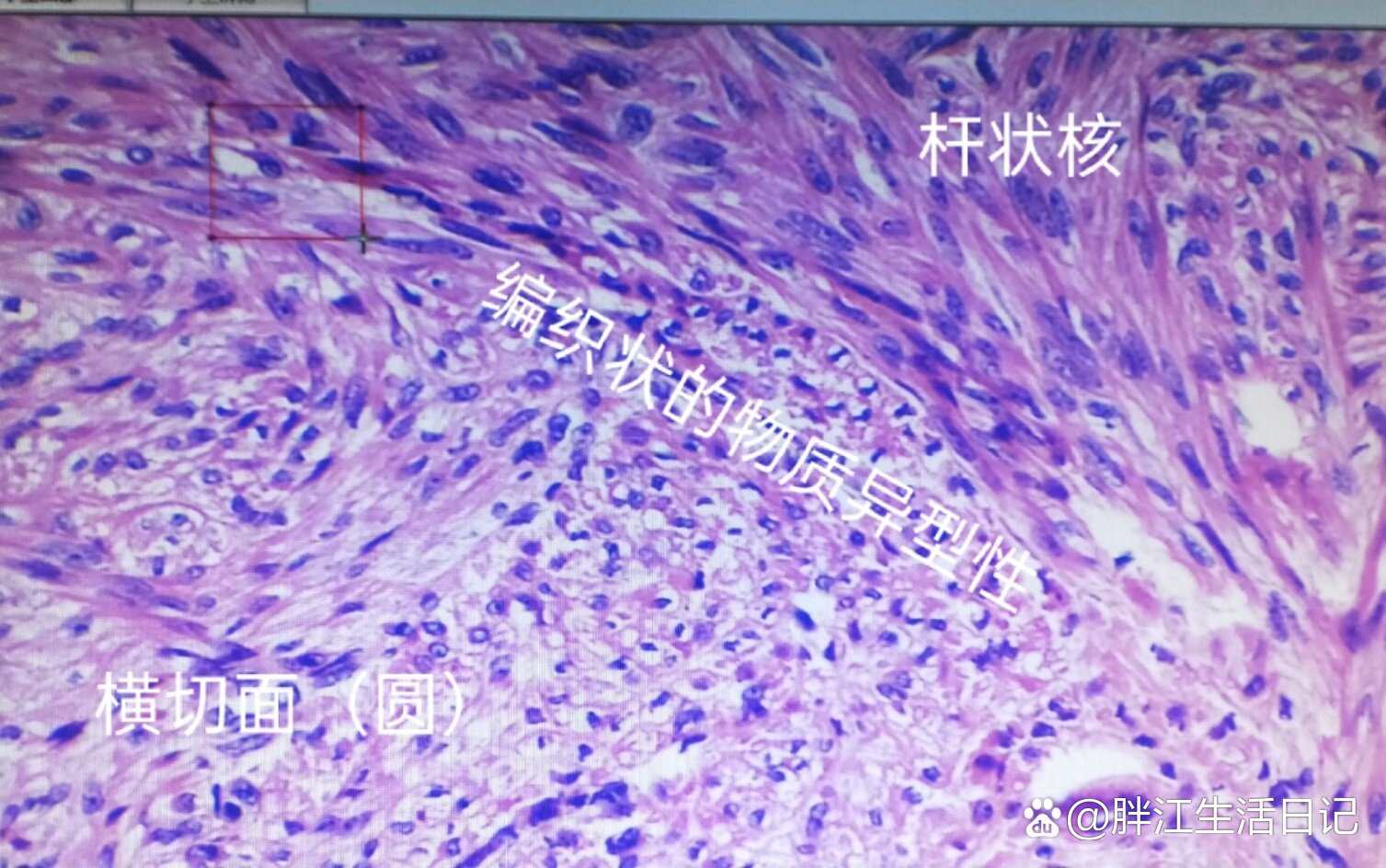 平滑肌刘细胞:杆状核