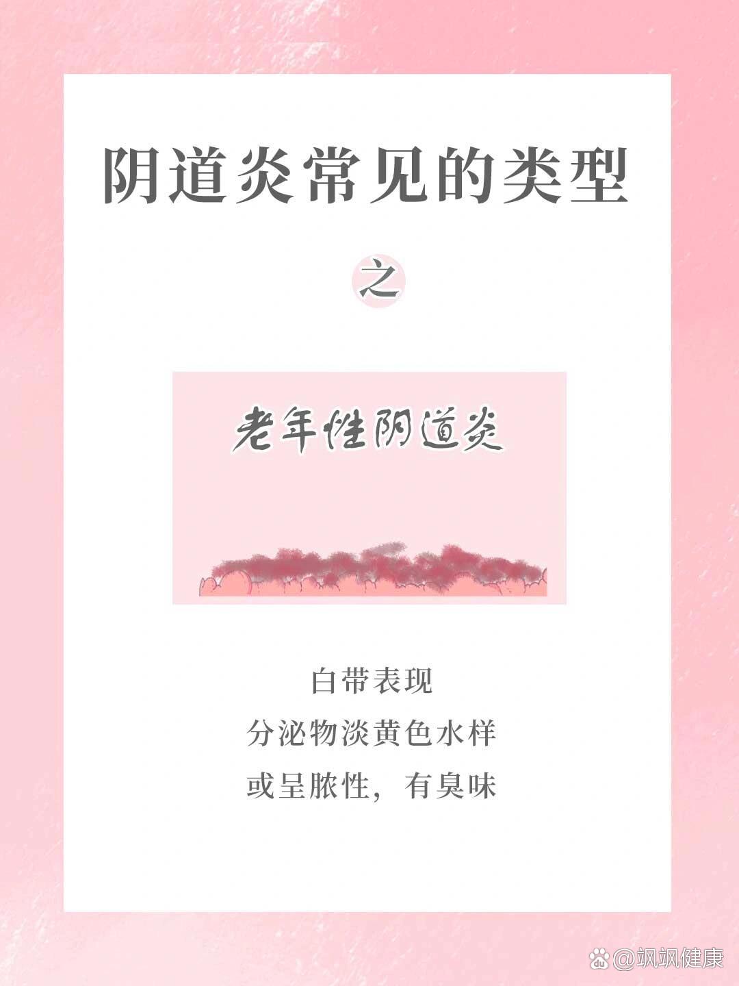 老年阴道炎94日常护理
