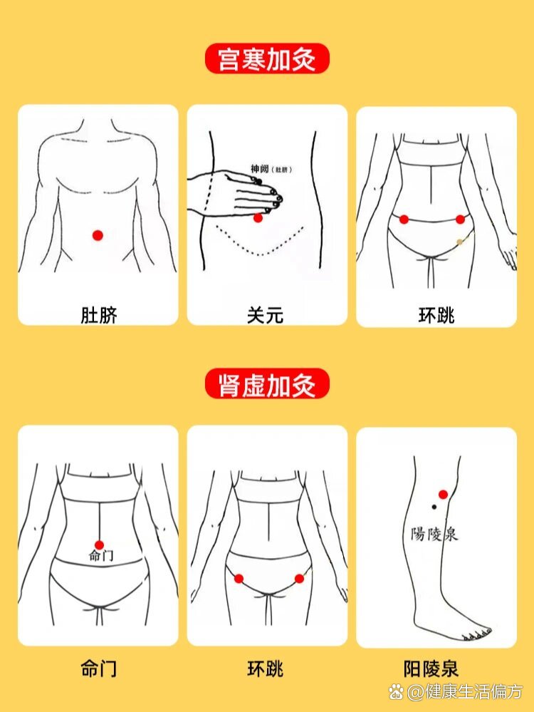 宫寒,肾虚,坚持这样艾灸一个月