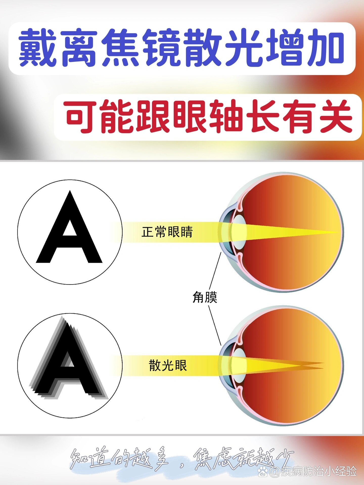 散光度数也会变化!