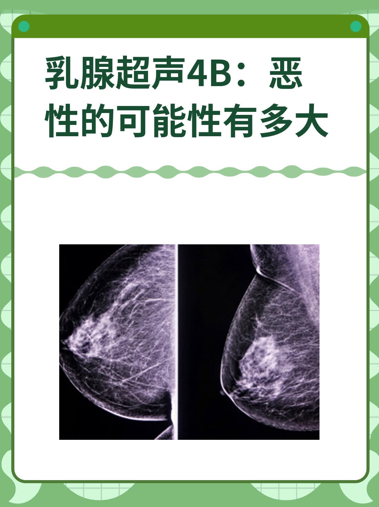 乳腺超声结构图图片