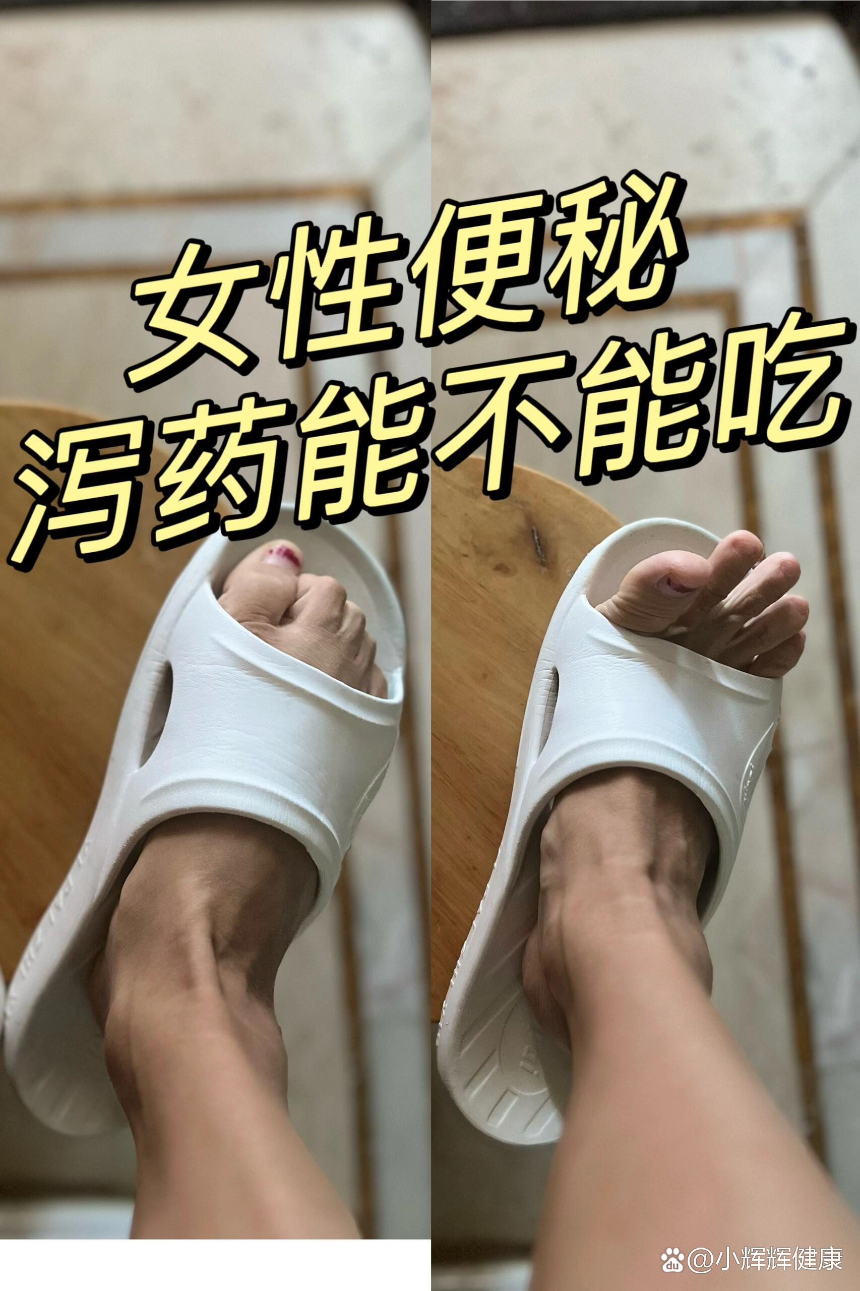 女性便秘图片