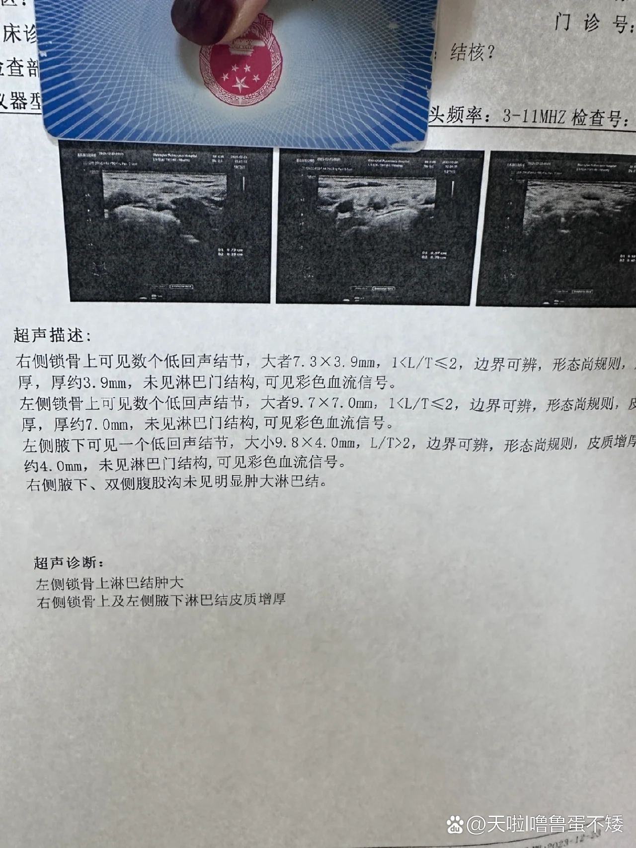 关于西苑医院代诊挂号服务复杂病情综合分析,治疗方向更明确的信息 关于西苑医院代诊挂号服务复杂病情综合分析,治疗方向更明确的信息