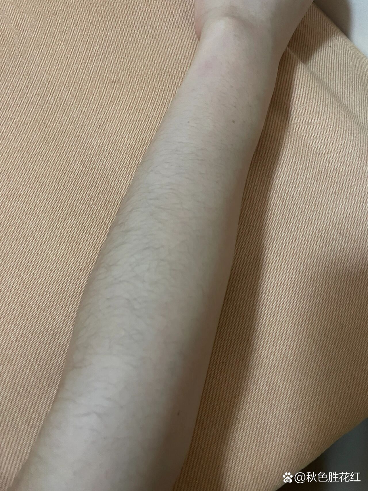 康佳冰点激光脱毛仪测评!