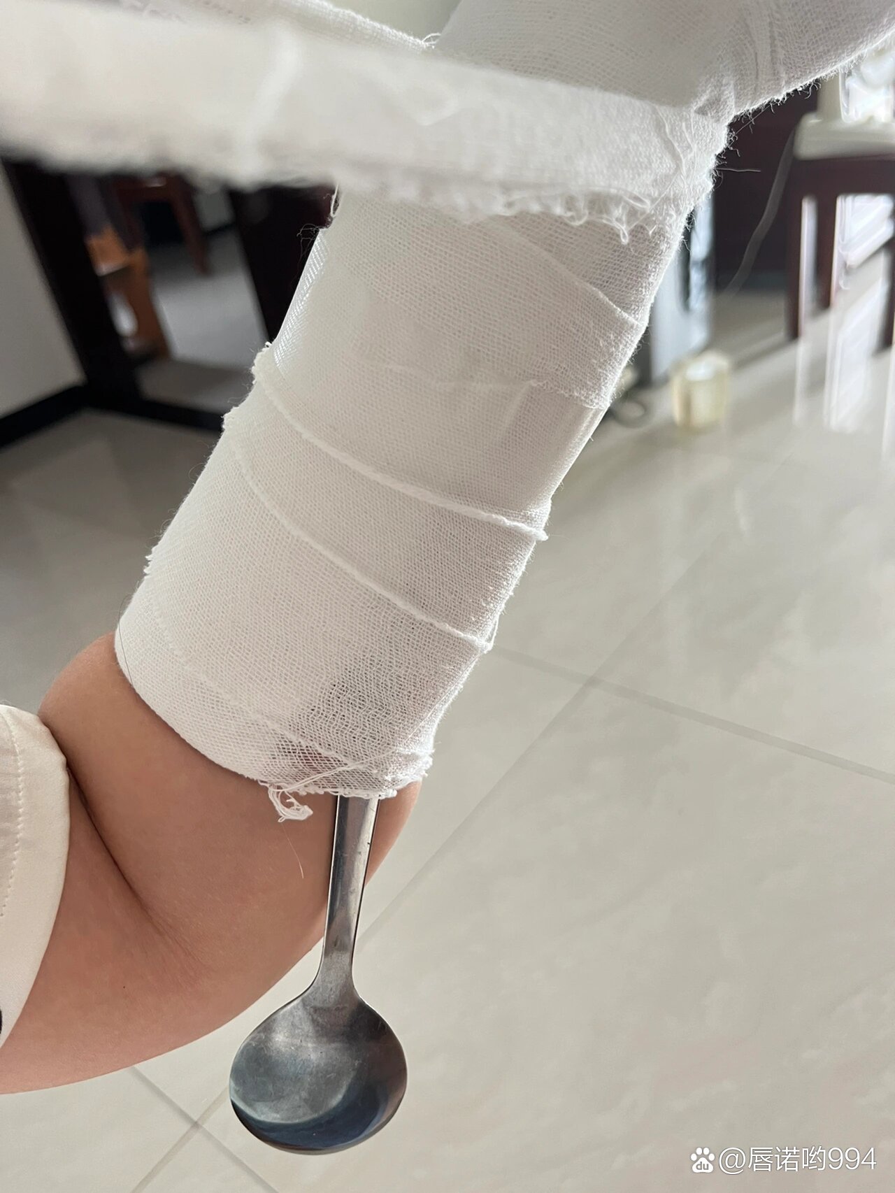  p>大家打石膏都怎么挠痒痒的 br>骨折第四天,打石膏的手臂奇痒无比