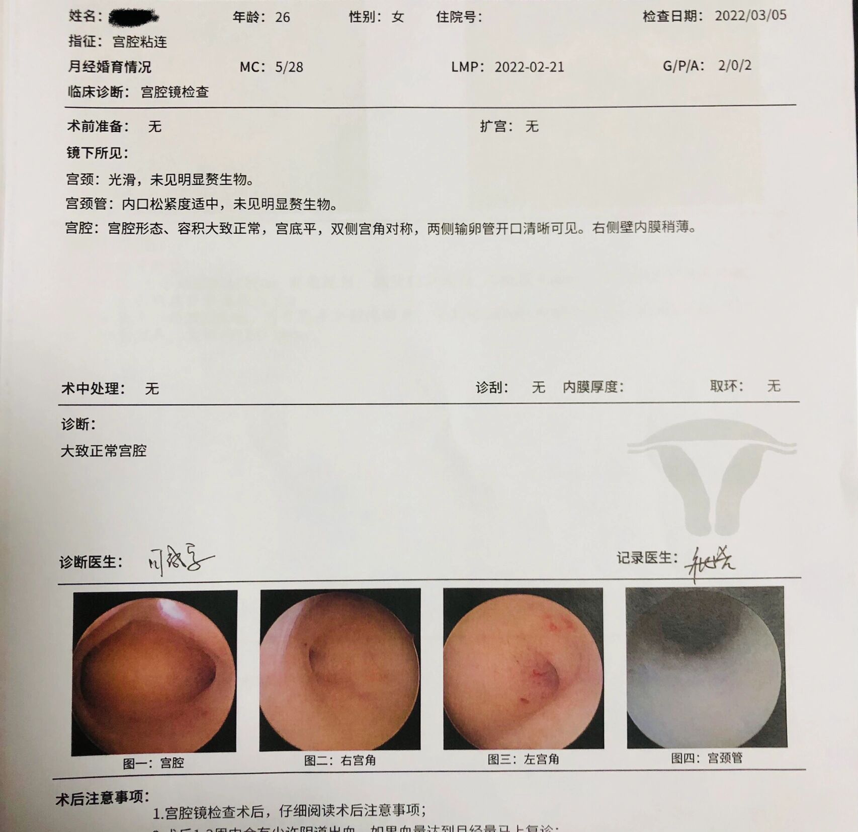 宫腔镜疼不疼图片