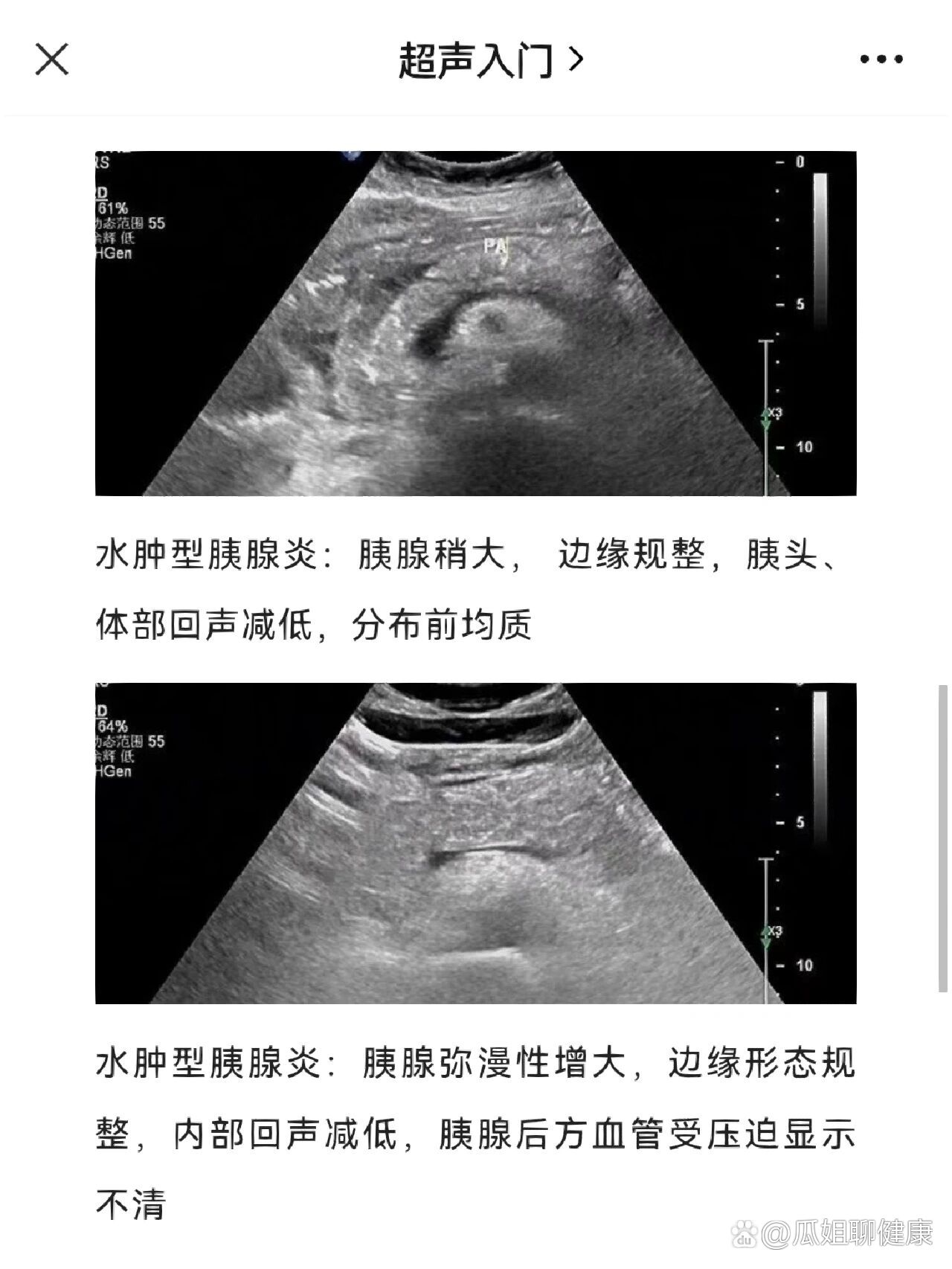 胰腺炎反射区的位置图图片