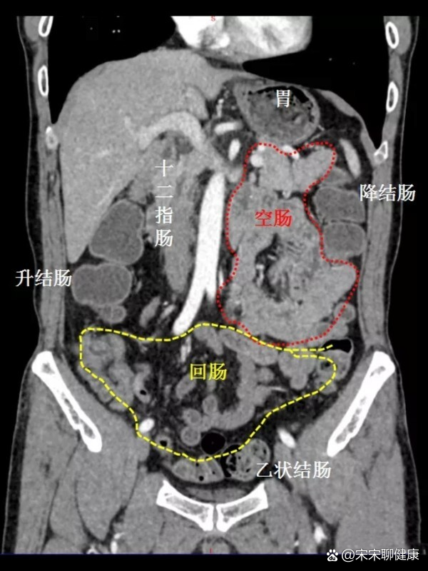 十二指肠分段图解图片