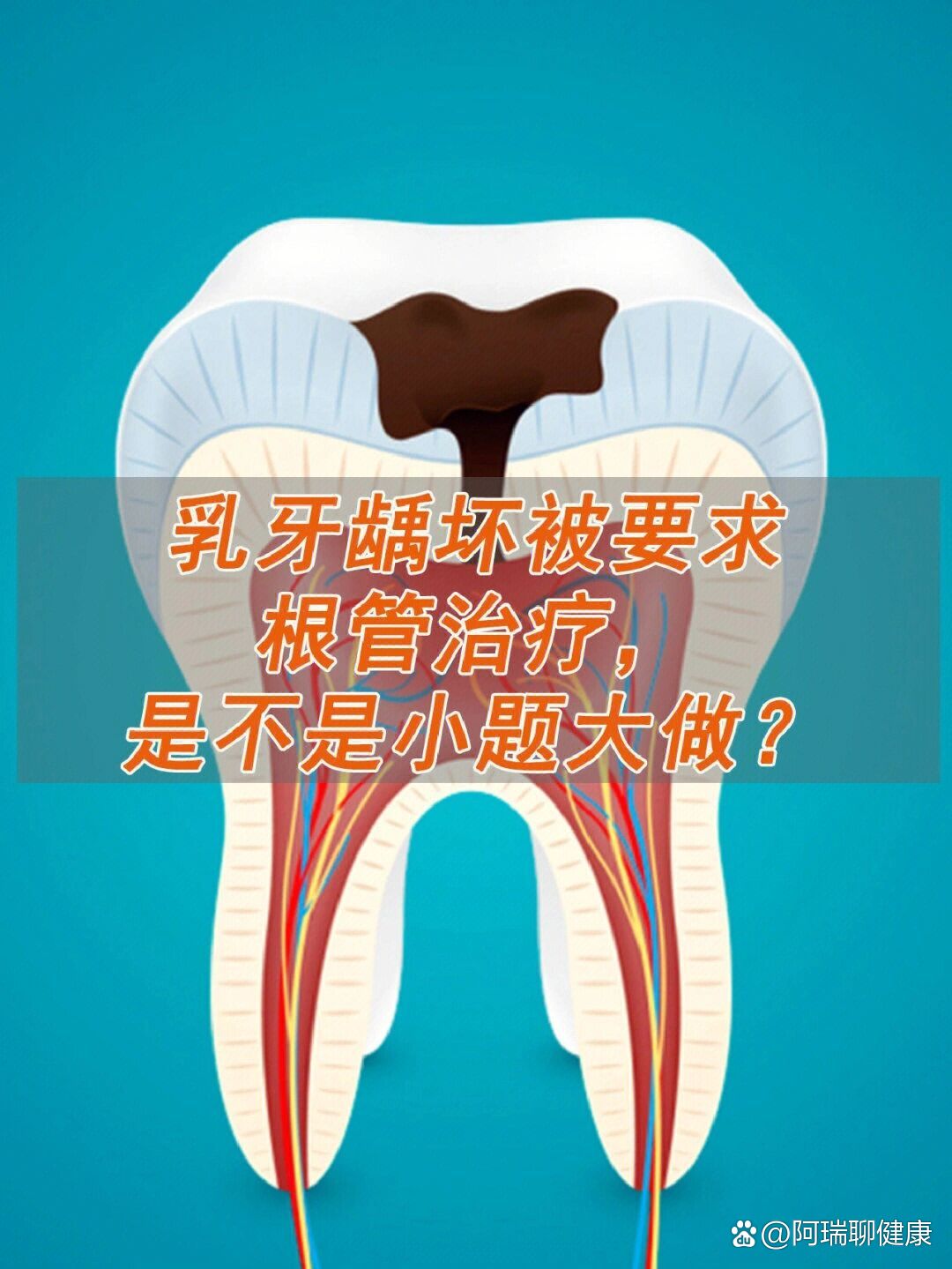 如果儿童乳牙也经受杀神经那么恒牙怎么办?不会有影响吗?