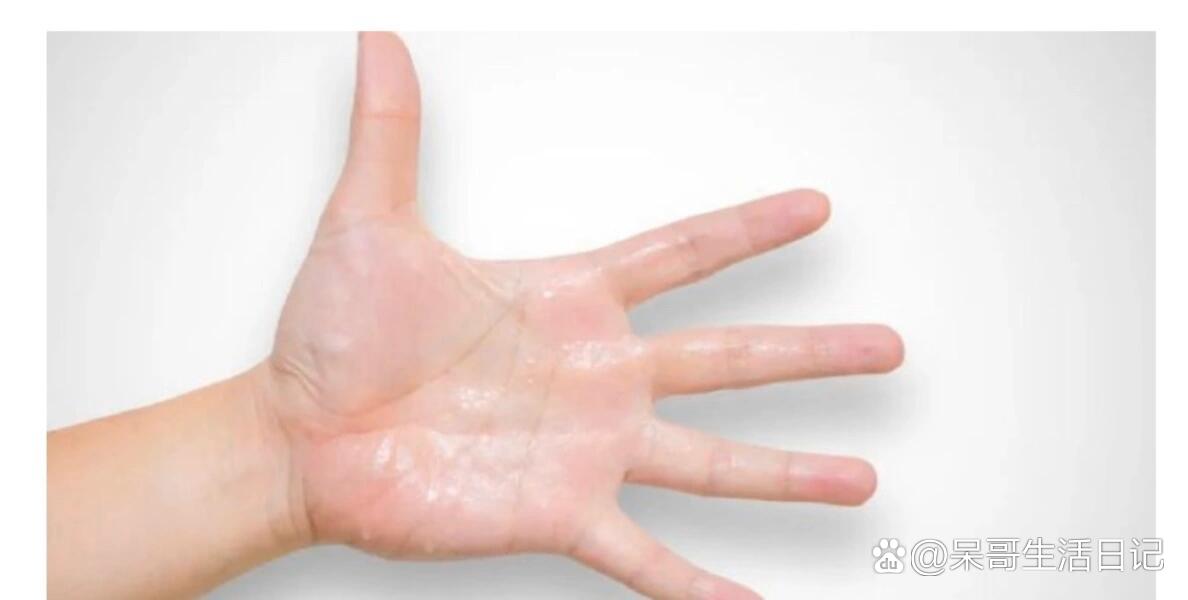 孩子手心,脚心出汗