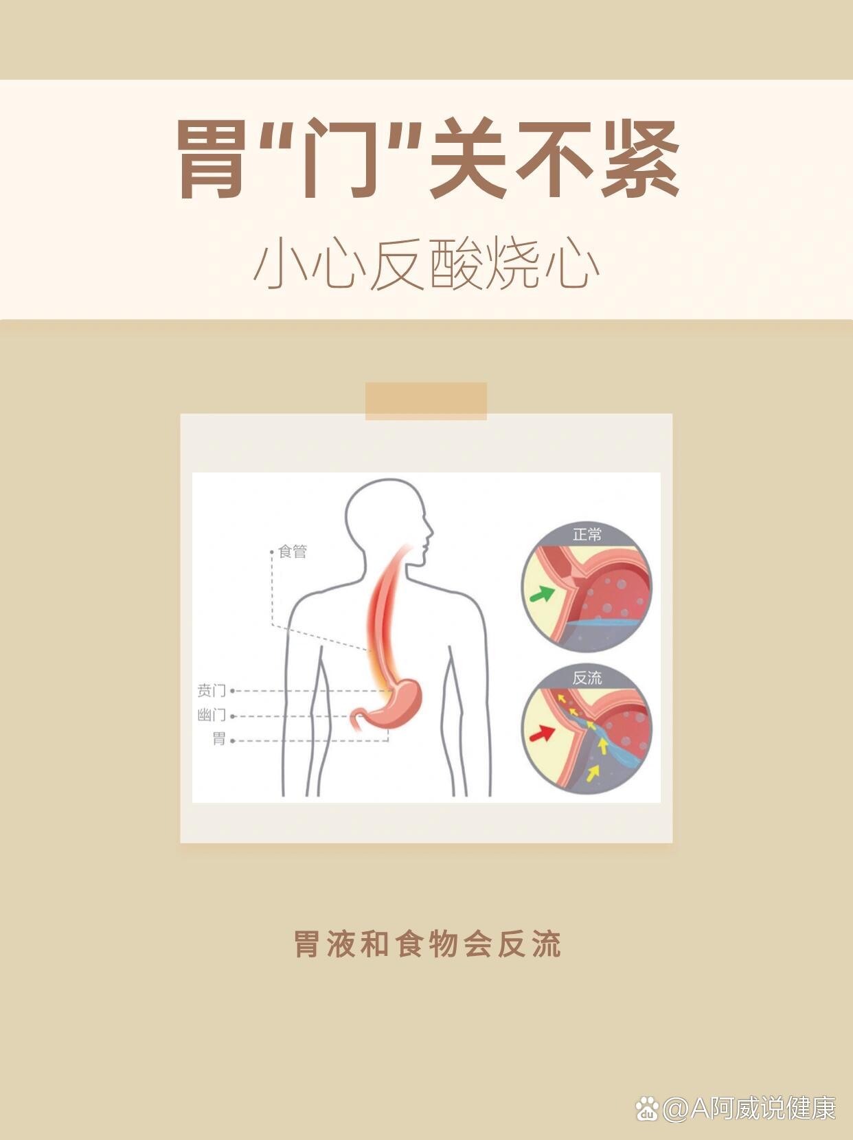 p 贲门松弛 反酸烧心 br 胃有两个开口🤔  br 👉进食物的叫贲门