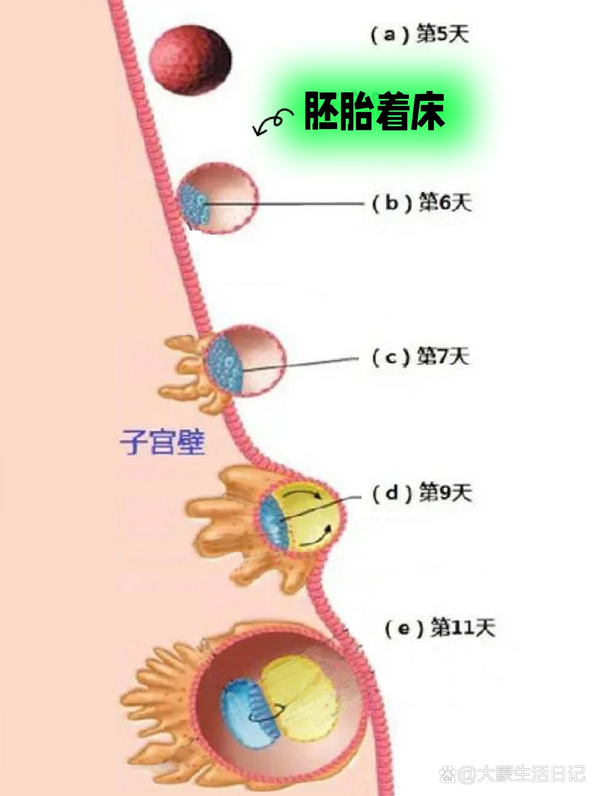 胚胎着床的正常位置图图片