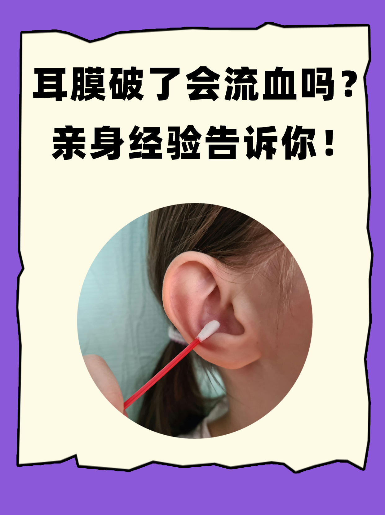 耳膜破了会流血吗?亲身经验告诉你