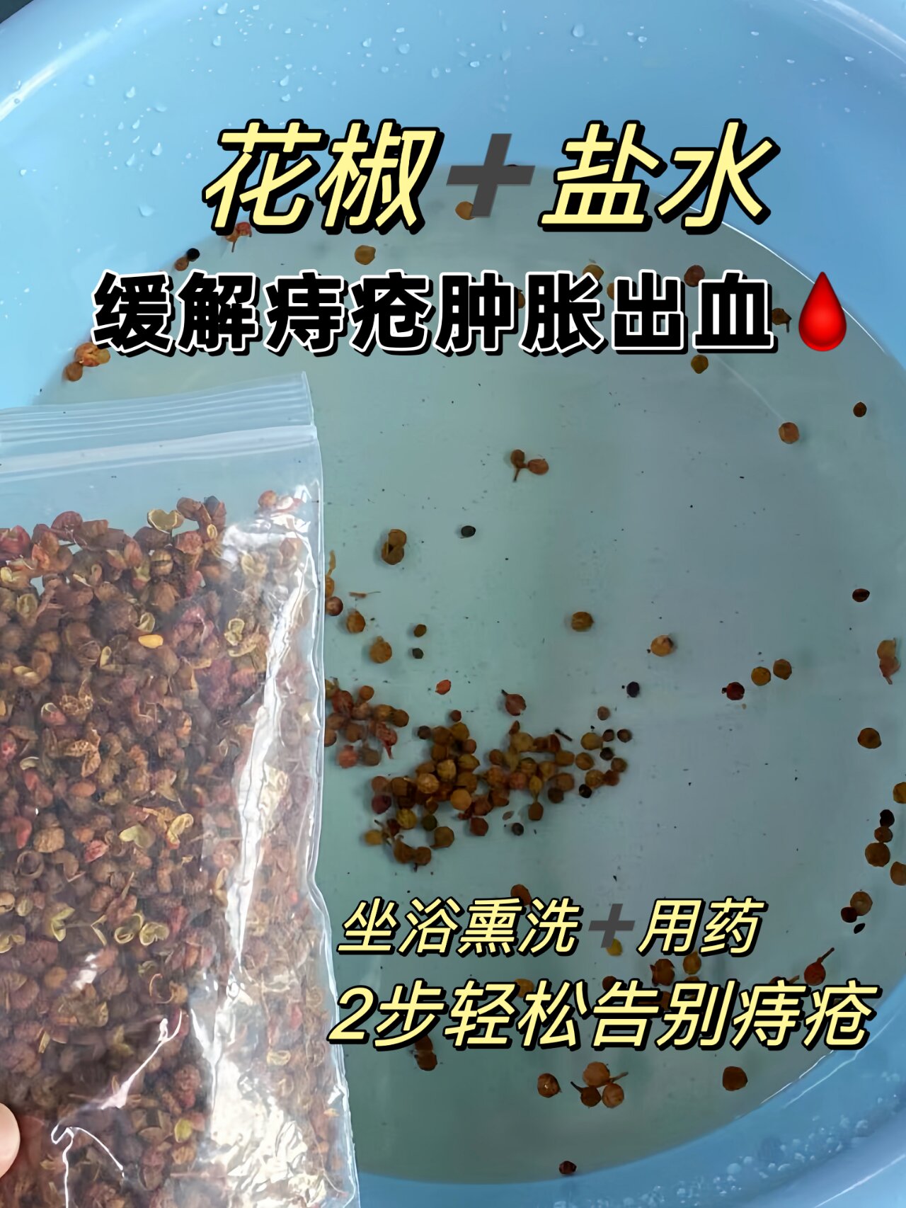 消失的痔疮,花椒 痔疮栓老家偏方是真牛