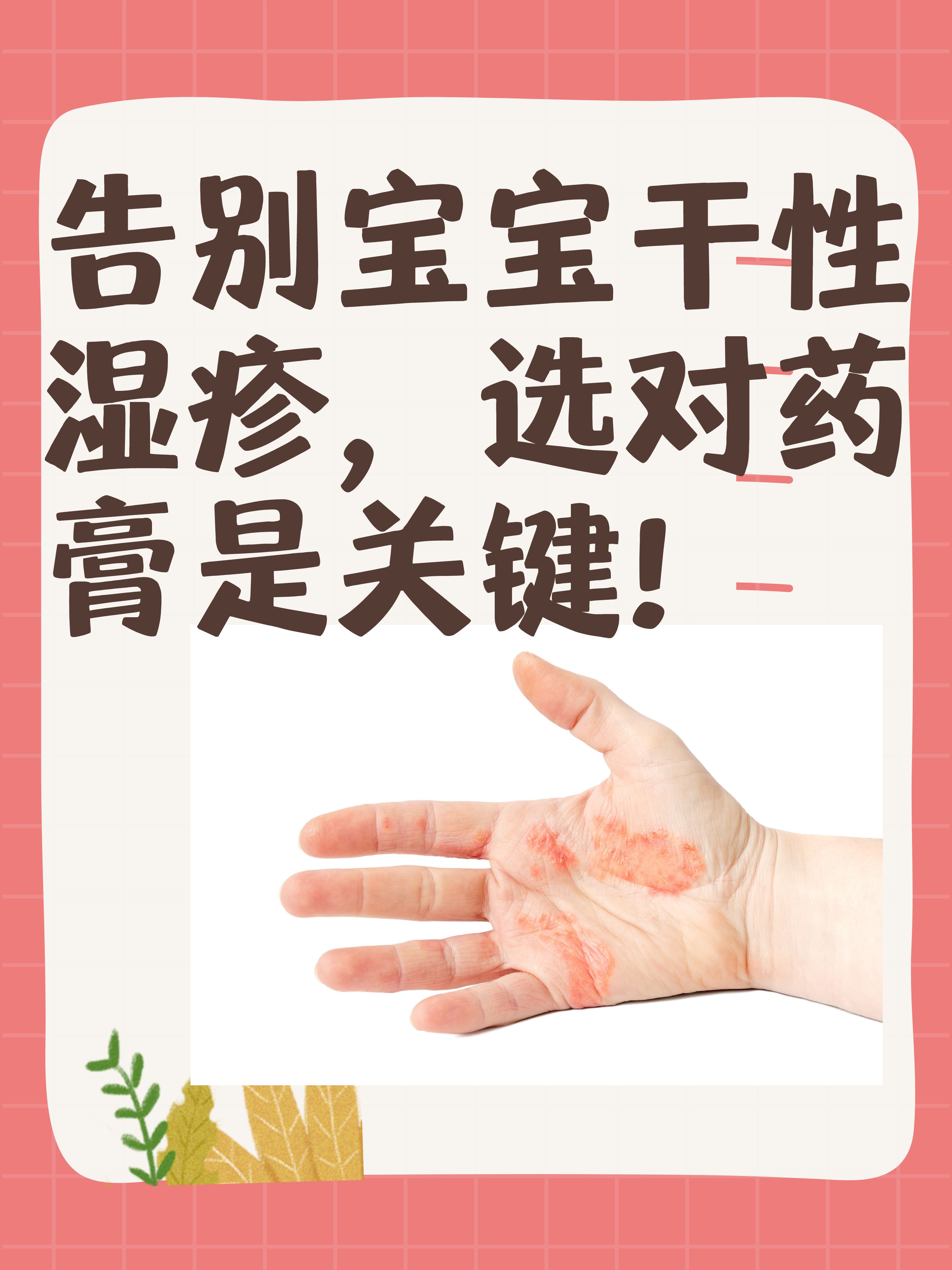 告别宝宝干性湿疹,选对药膏是关键!
