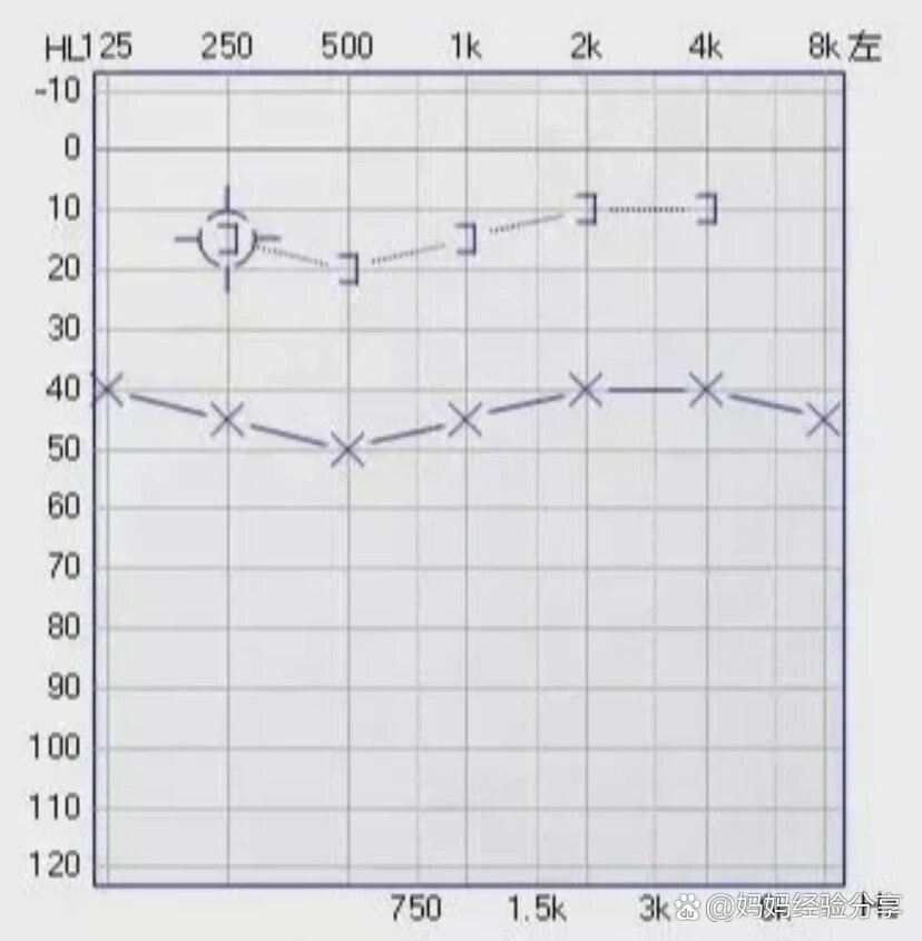 一分钟教你看懂耳朵听力检查报告