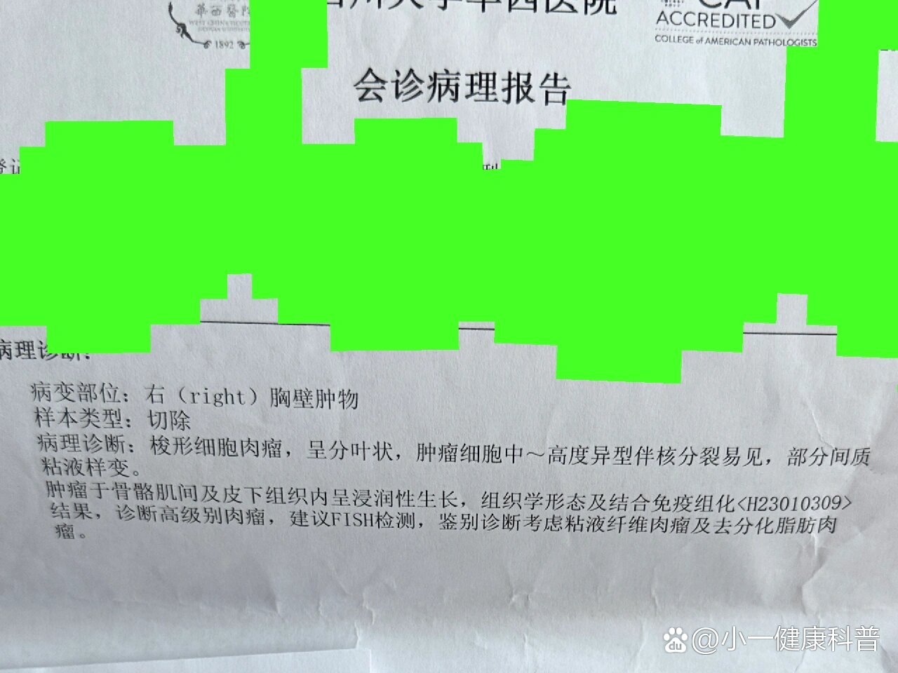梭形细胞肉瘤,高级别恶性肿瘤,华西