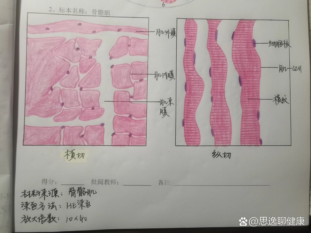 横纹肌 手绘图图片