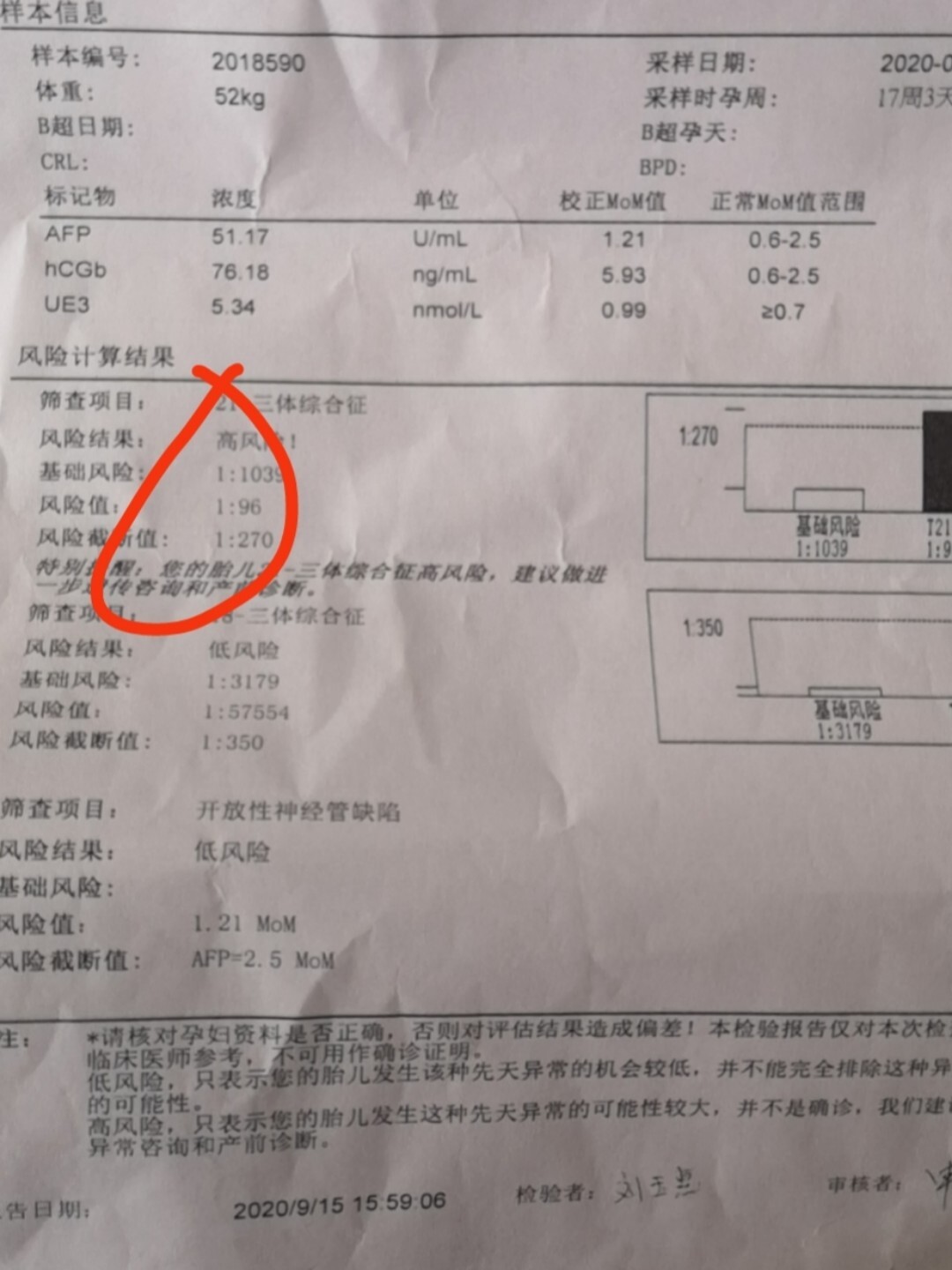 一,唐筛21–三体高风险,羊水穿刺顺利通关