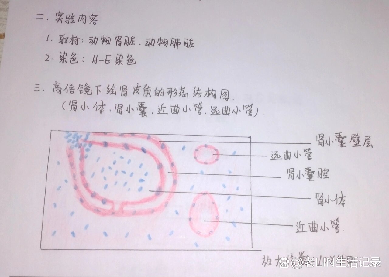 肾小体手抄报图片