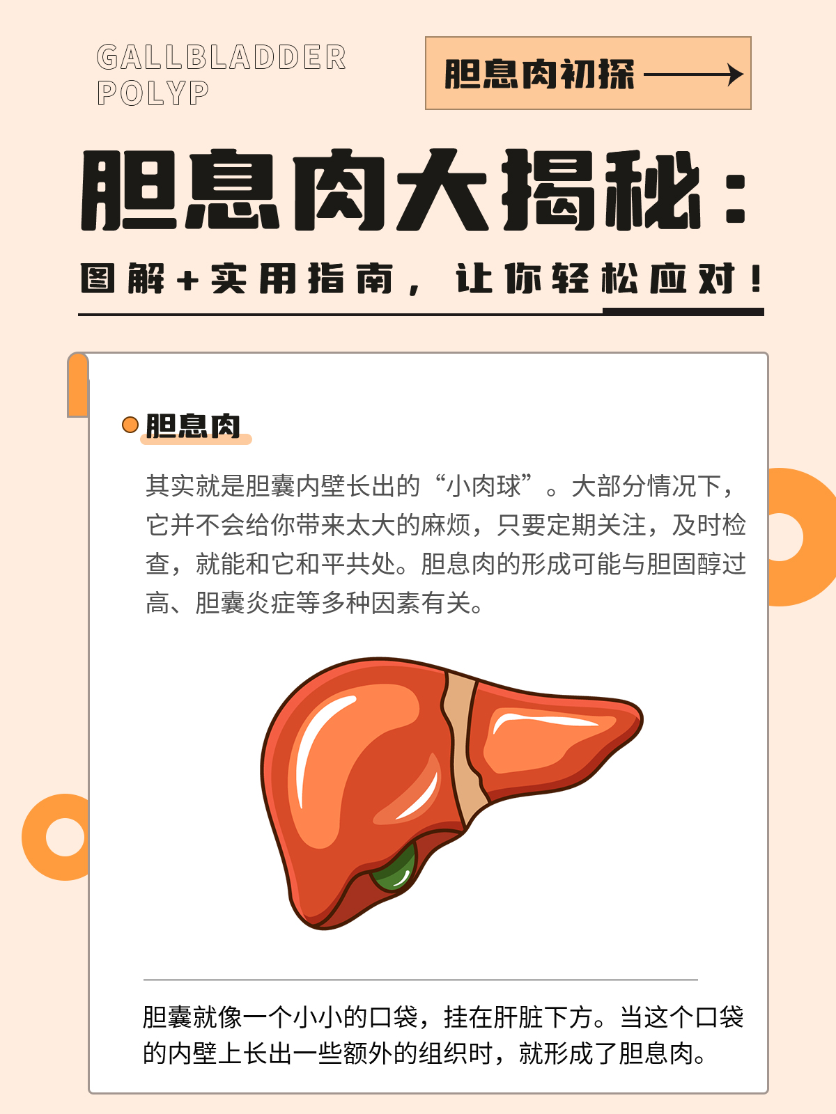 胆囊息肉是怎么引起的图片