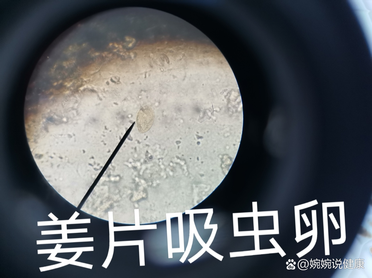 显微镜下各种寄生虫虫卵.
