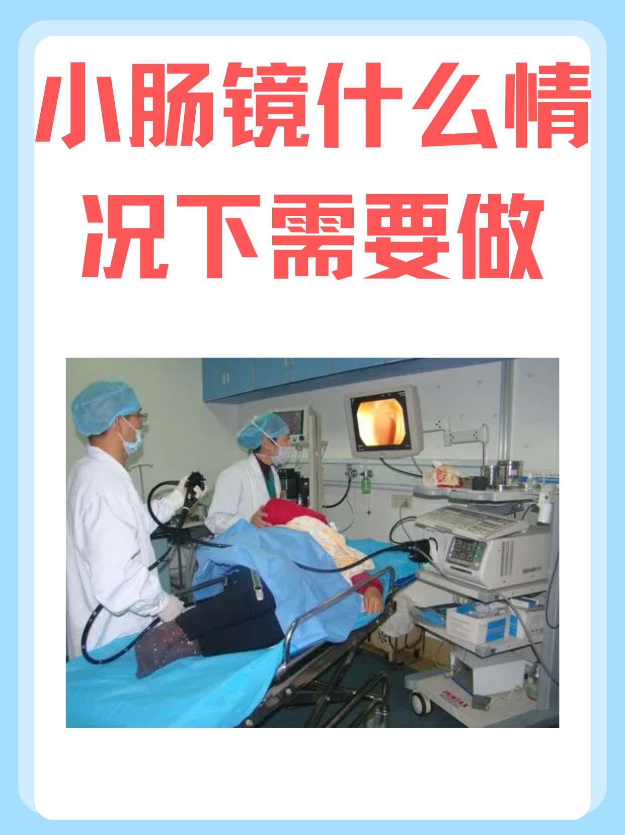 小肠镜检查必要性:什么情况下需要做?