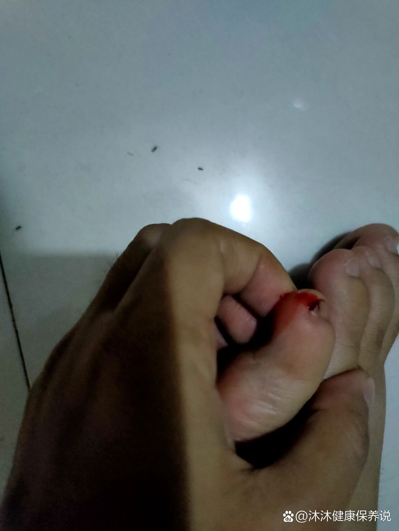 有没有人和我一样最小的脚趾会撞出血