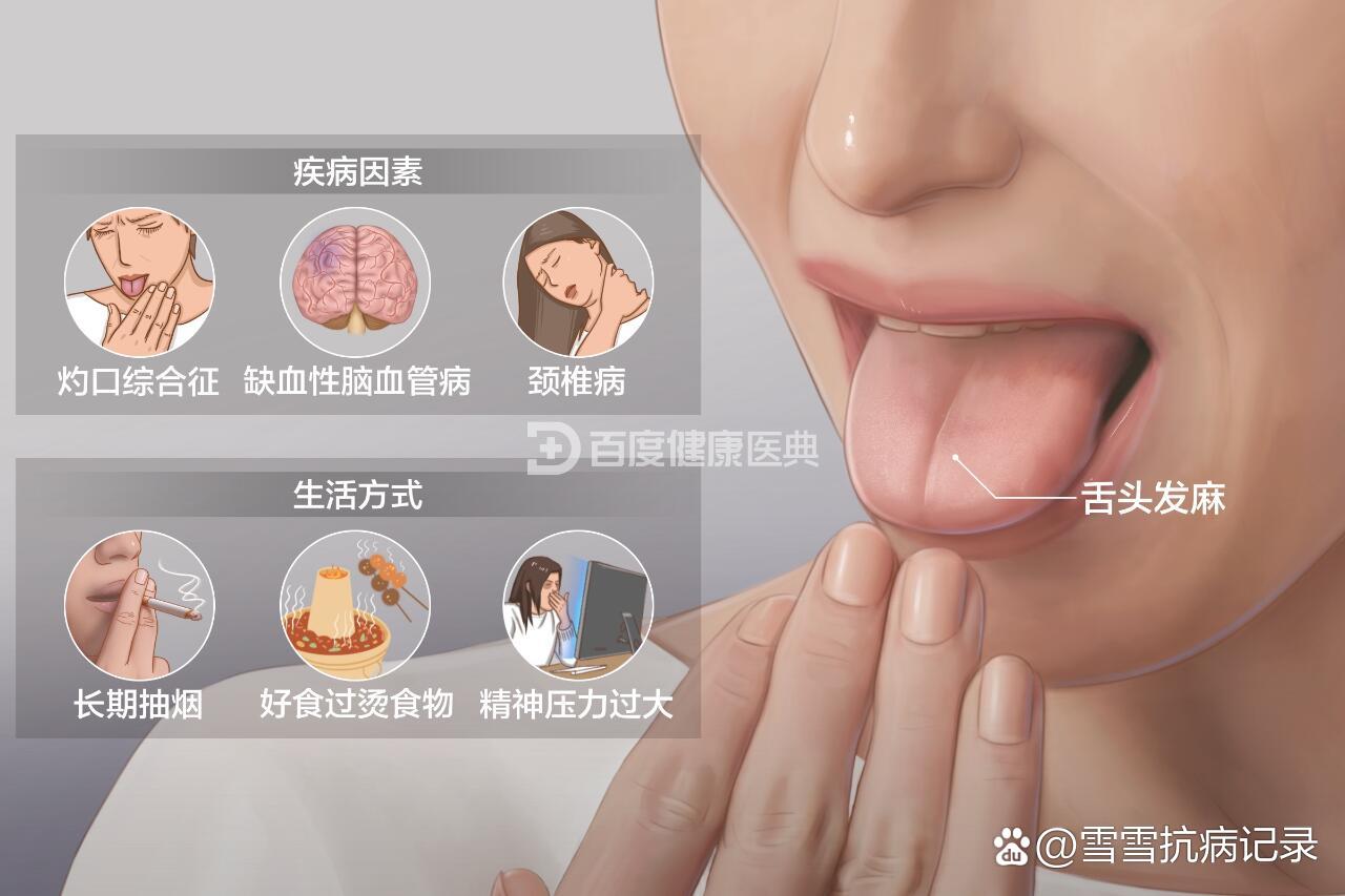 04舌头发麻怎么办71