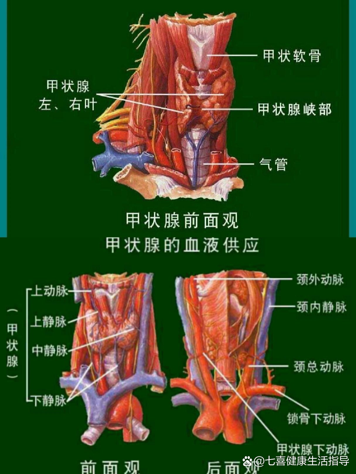 甲状腺肿大分度图片