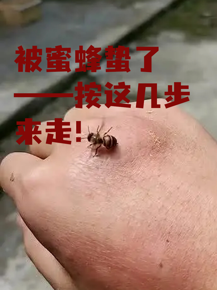 梦见蜂蜜追我蛰我头(梦见蜂蜜追我蛰我头上)