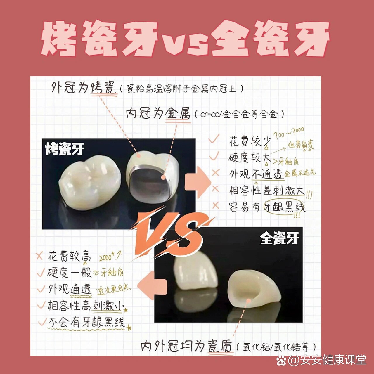 镶烤瓷牙过程图解图片