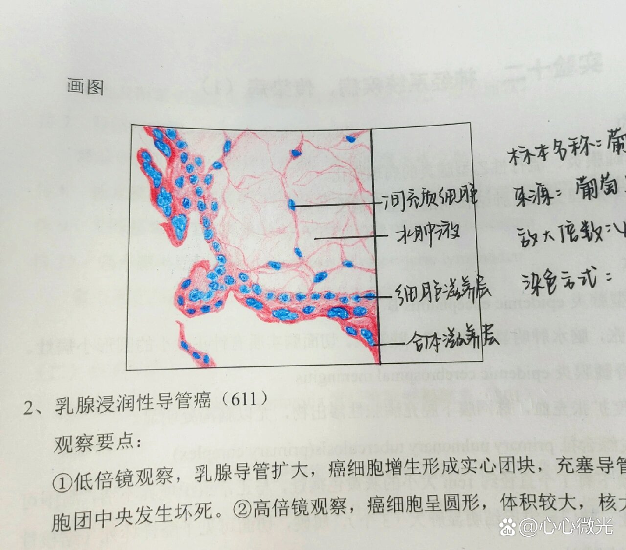 甲状腺切片手绘图图片