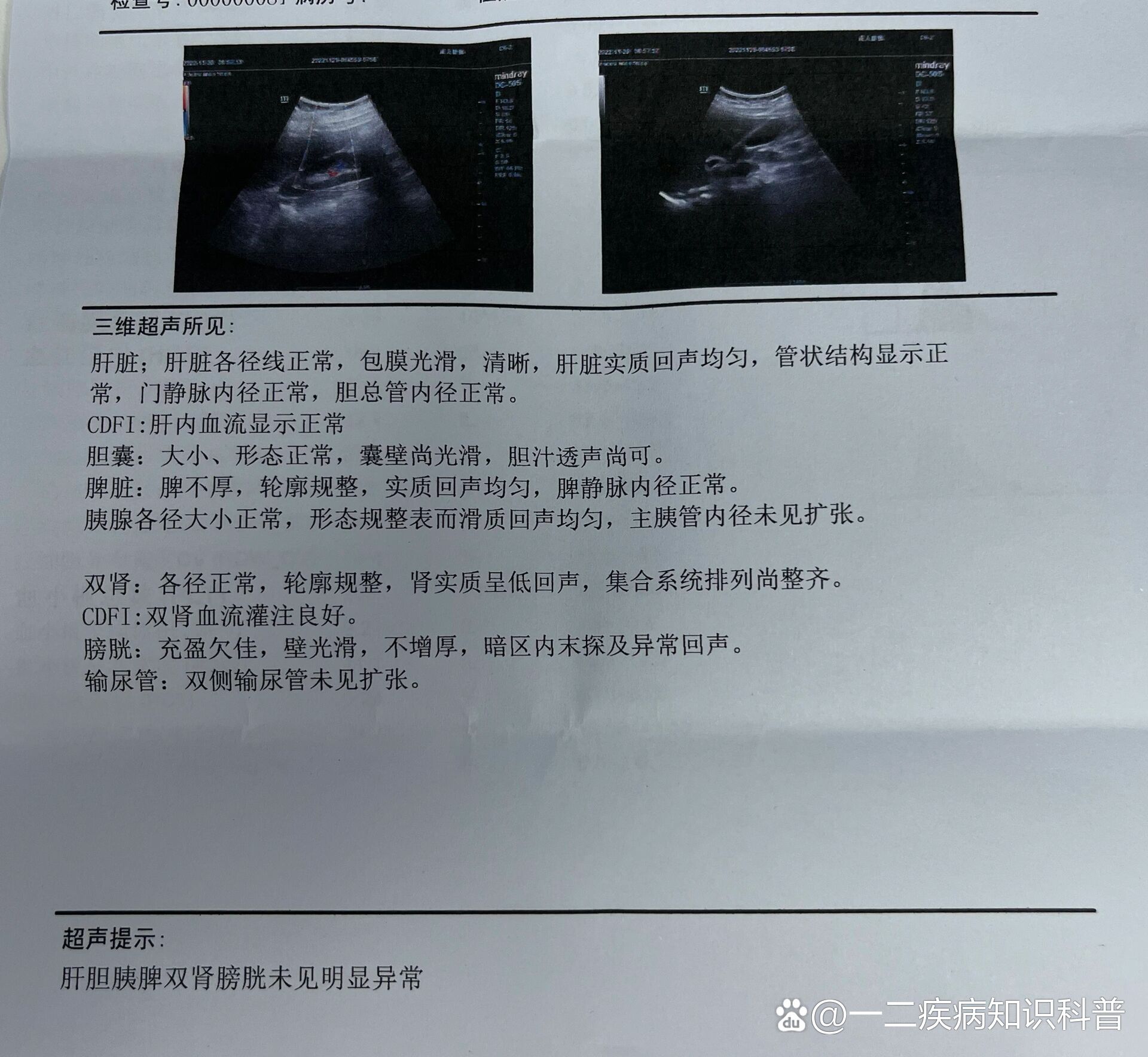 最近又疼了两次,决定去附近的小医院检查一下,医生说做个腹部彩超