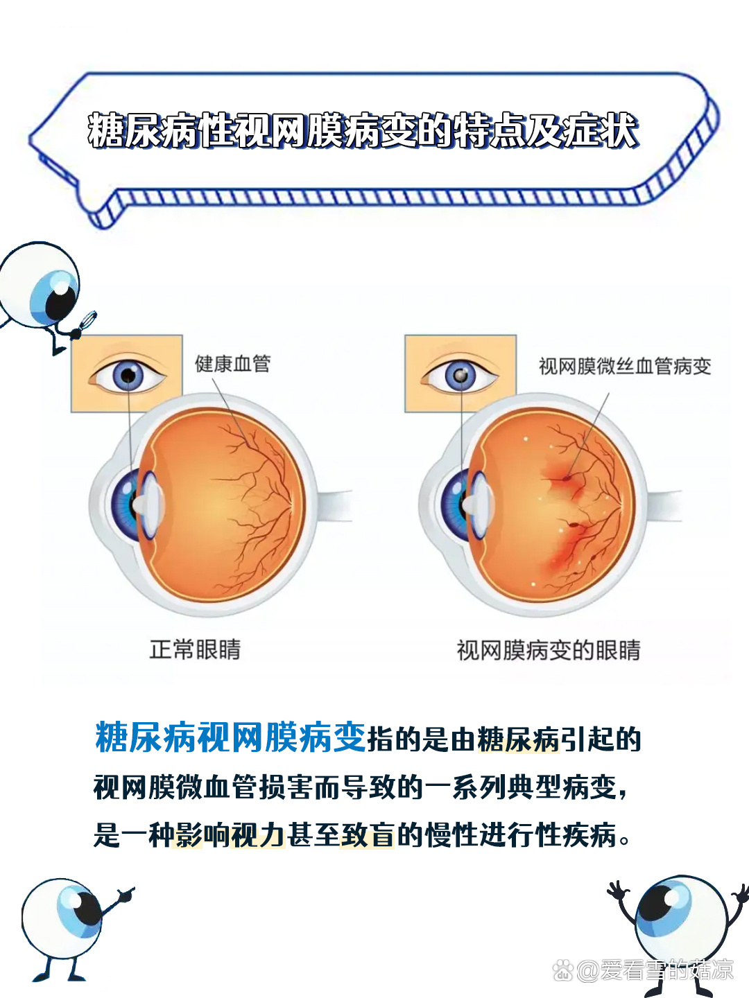 糖尿病性视网膜06变的症状及特点
