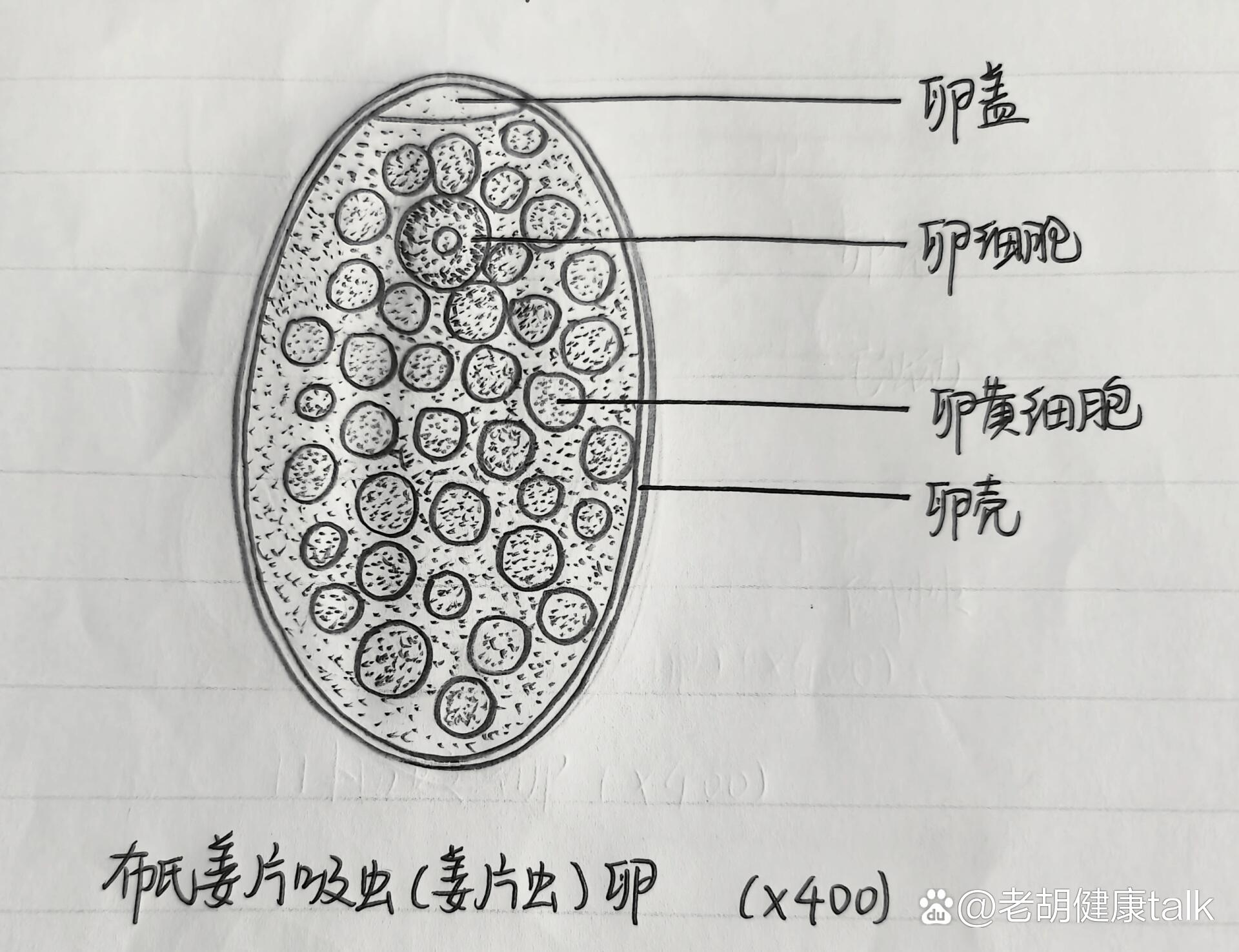 布氏姜片吸虫成虫图片