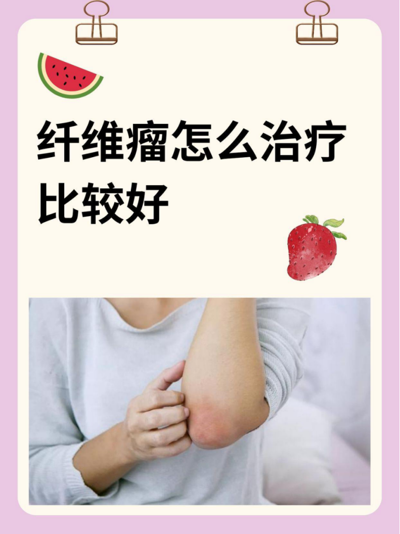 我的纤维瘤治疗之旅,哪种方法更适合你?