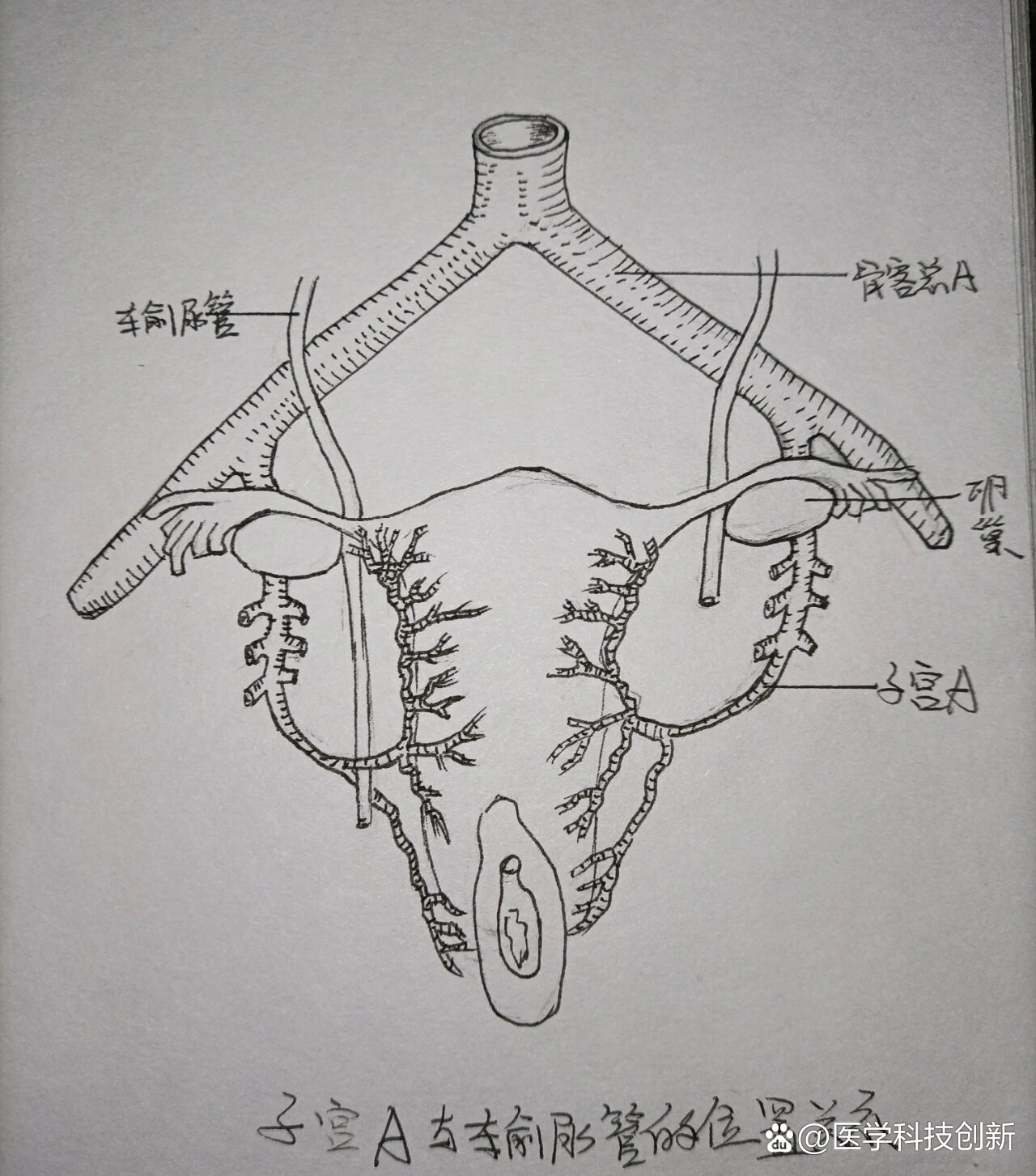 女性输尿管走形图片图片