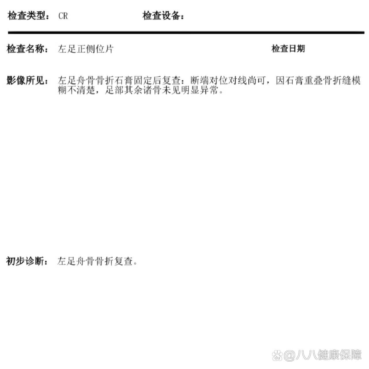 舟骨撕脱骨折图片