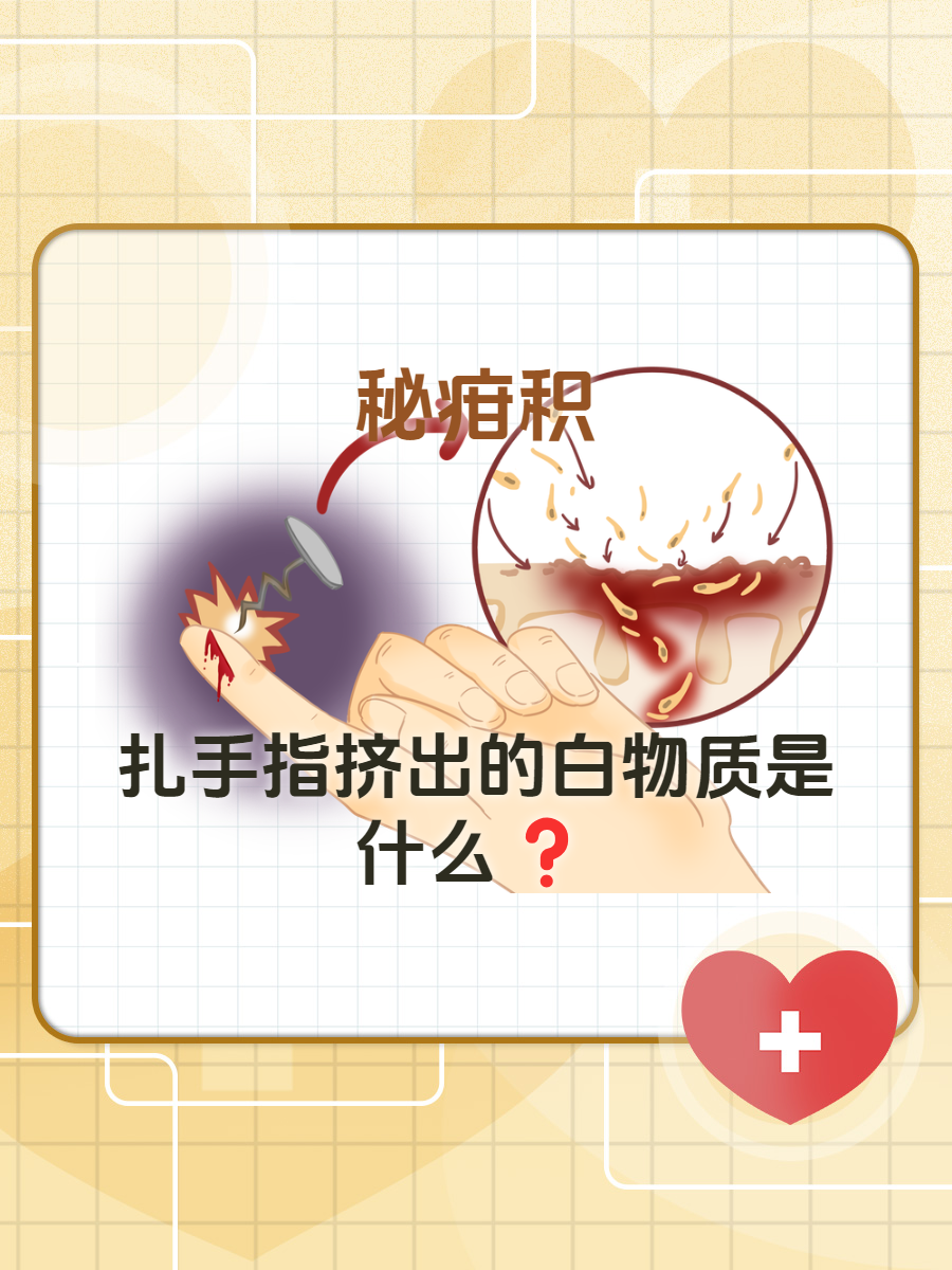 秘疳积:扎手指挤出的白物质是什么?