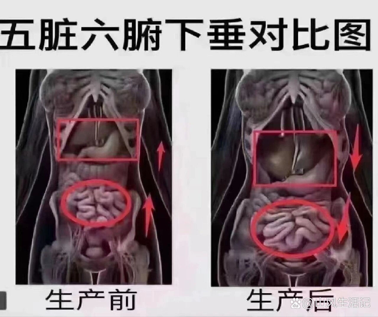 只有生过娃的人才知道什么是内脏下垂?