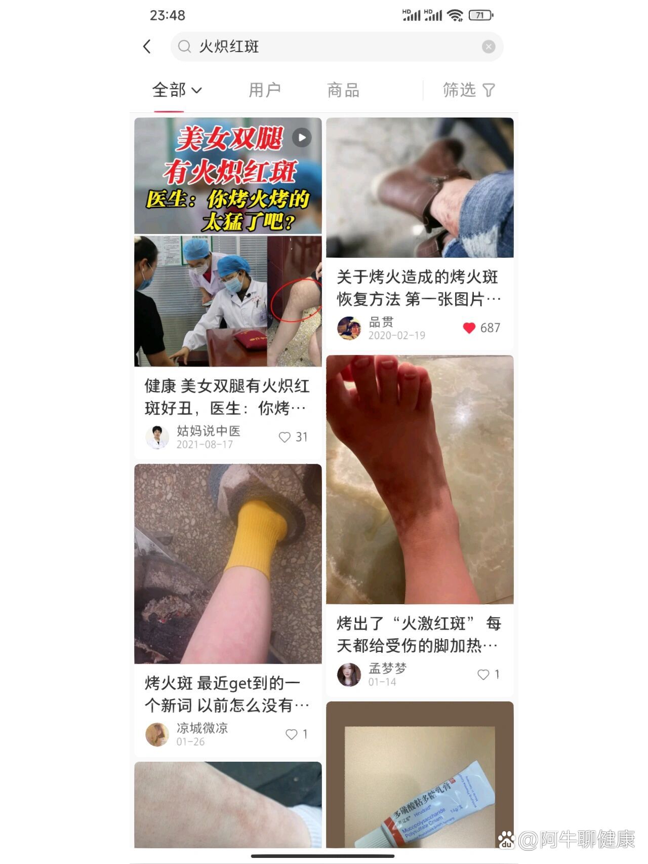 烤火斑要怎么消除01为了拯救鸡皮肤开始涂