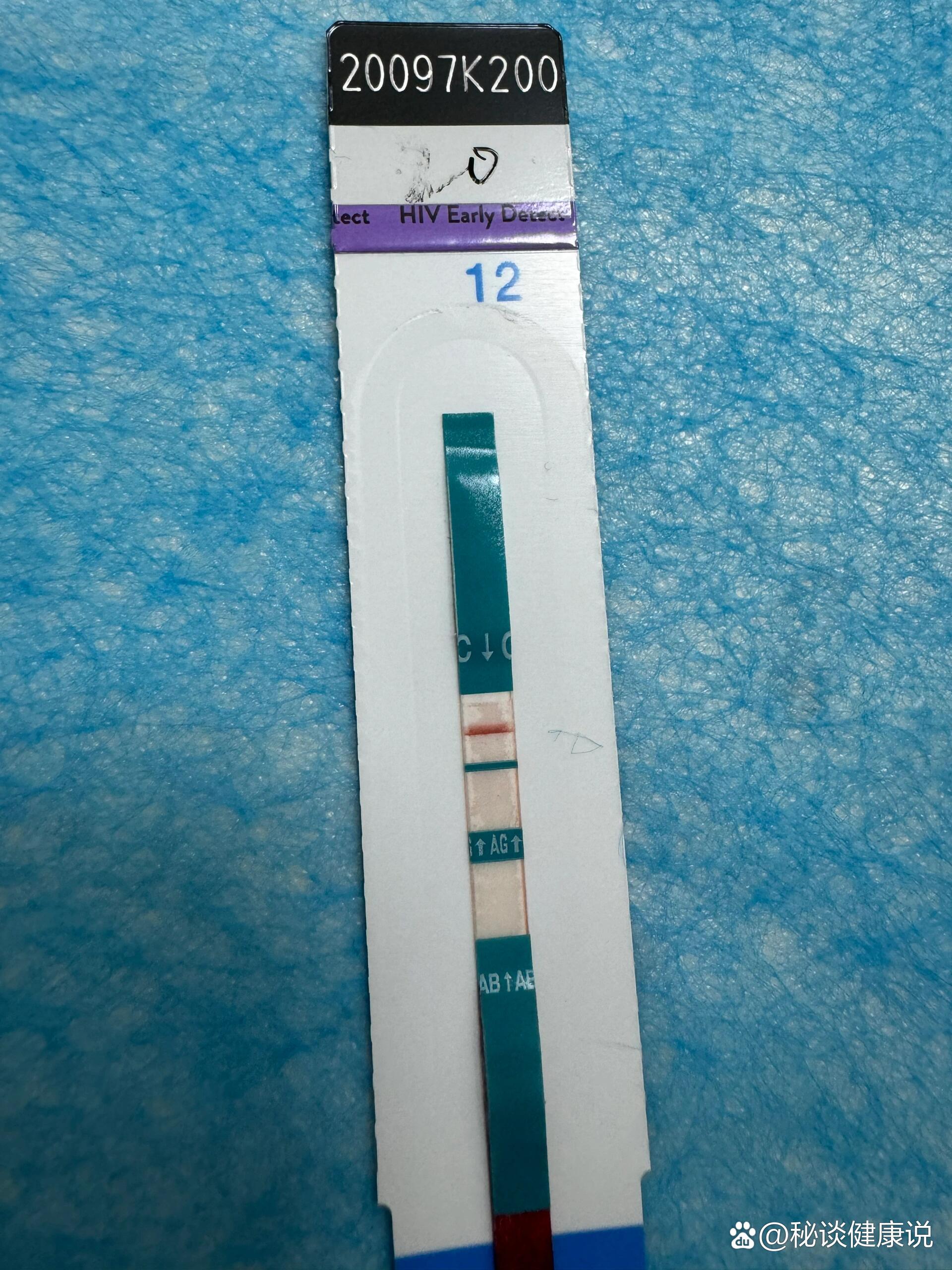 hiv检测初筛假阳?